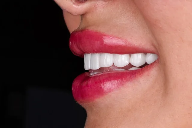 Sourire illustrant l’esthétique dentaire à Harmony Clinic